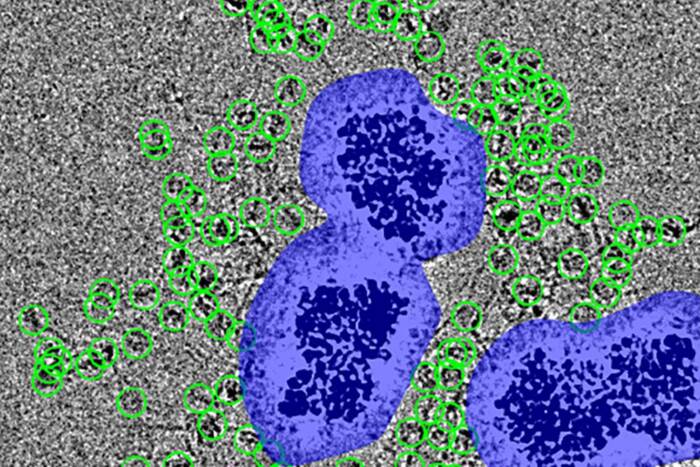 Particles are encircled in green and nanobeads are surrounded by white noise (in blue) on a gray background
