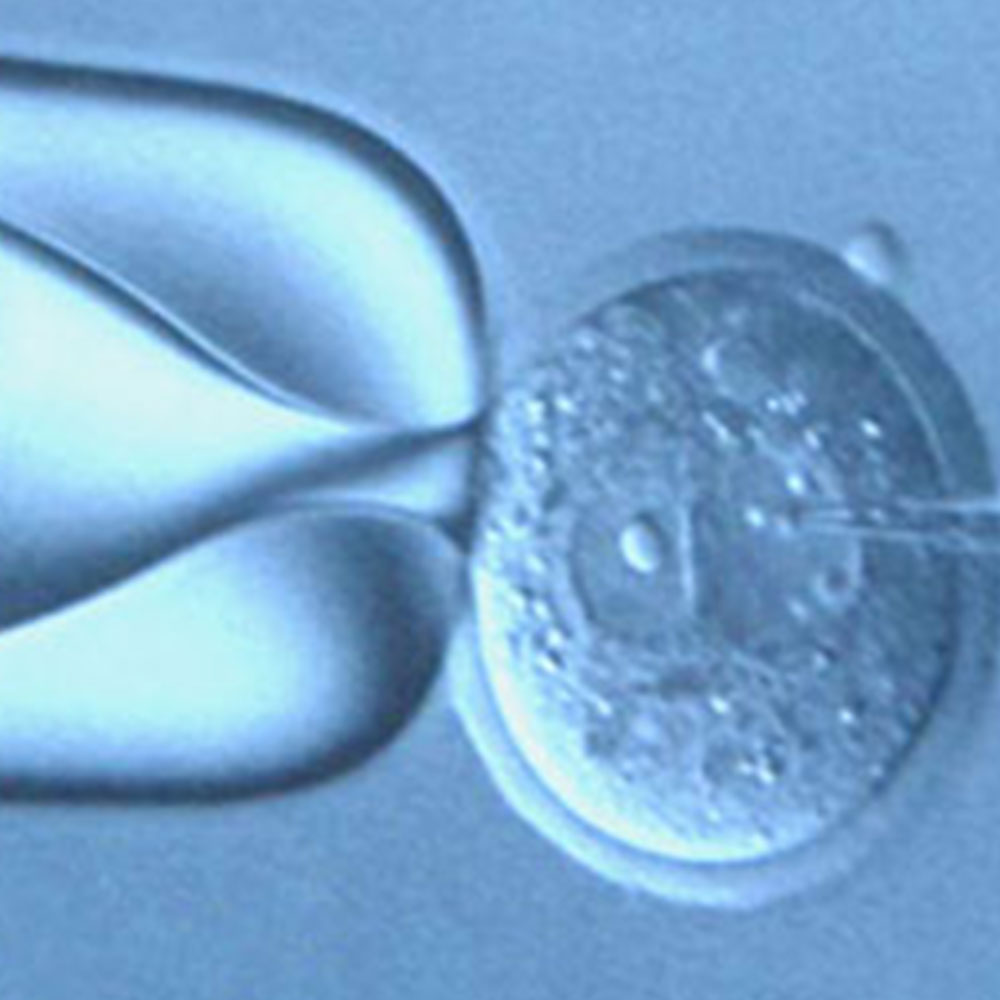Transgenic and Reproductive Technology